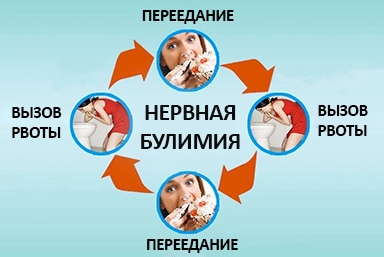 Лечение булимии в Тогучине